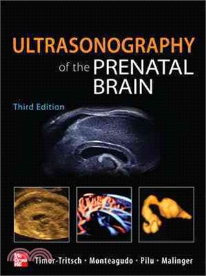 Ultrasonography of the Prenatal & Neonatal Brain