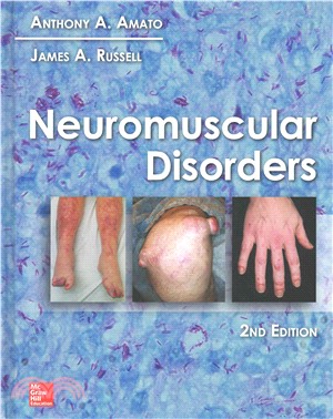 Neuromuscular Disorders