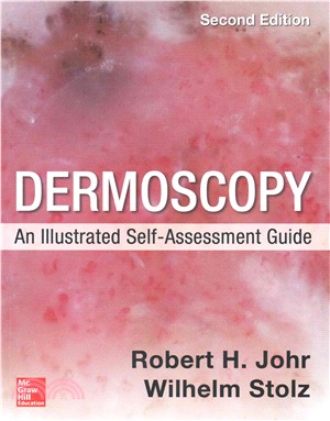 Dermoscopy ― An Illustrated Self-assessment Guide