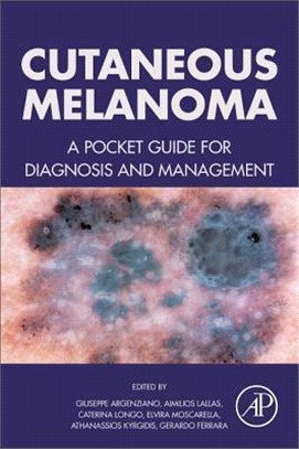 Cutaneous Melanoma ― A Pocket Guide for Diagnosis and Management