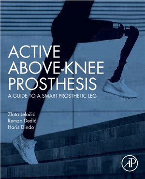 Active Above-Knee Prosthesis：A Guide to a Smart Prosthetic Leg