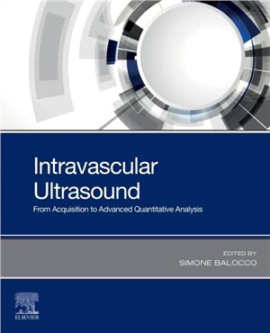 Intravascular Ultrasound：From Acquisition to Advanced Quantitative Analysis