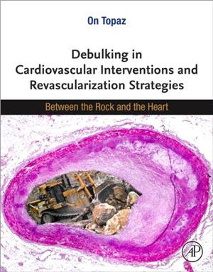 Debulking in Cardiovascular Interventions and Revascularization Strategies：Between the Rock and the Heart