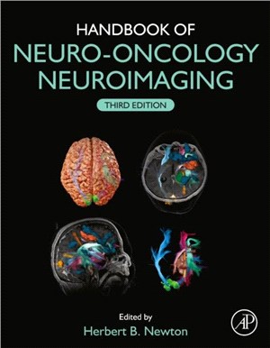 Handbook of Neuro-Oncology Neuroimaging