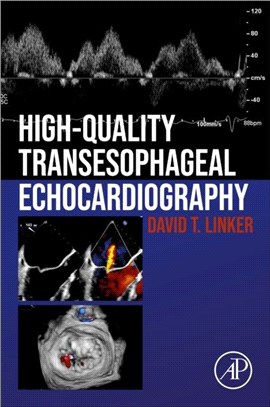 High-Quality Transoesophageal Echocardiography
