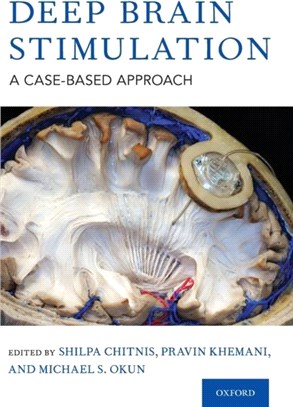 Deep Brain Stimulation：A Case-based Approach