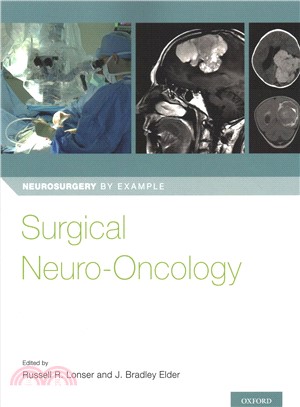 Surgical Neuro-oncology