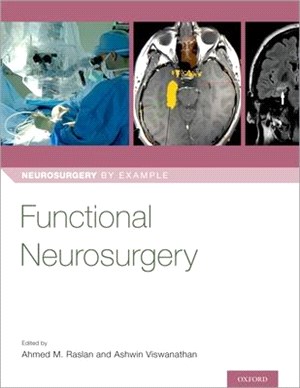 Functional Neurosurgery