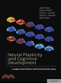 Neural Plasticity and Cognitive Development ─ Insights from Children With Perinatal Brain Injury