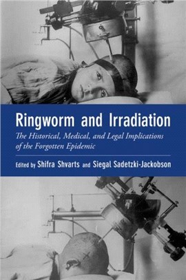 Ringworm and Irradiation：The Historical, Medical, and Legal Implications of the Forgotten Epidemic