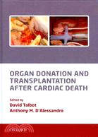 Organ Donation and Transplantation After Cardiac Death