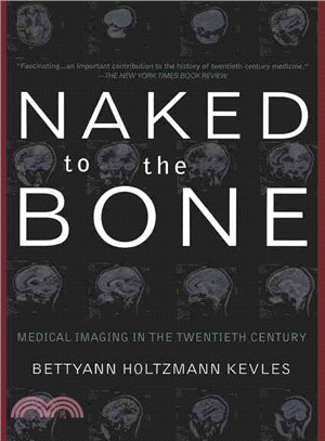 Naked to the Bone ─ Medical Imaging in the Twentieth Century