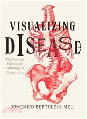 Visualizing Disease ─ The Art and History of Pathological Illustrations