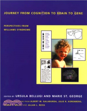 Journey from Cognition to Brain to Gene ― Perspectives from Williams Syndrome