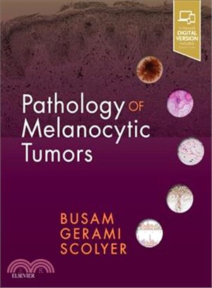 Pathology of Melanocytic Tumors