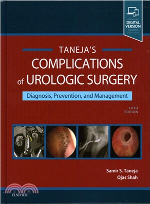 Complications of Urologic Surgery ─ Prevention and Management