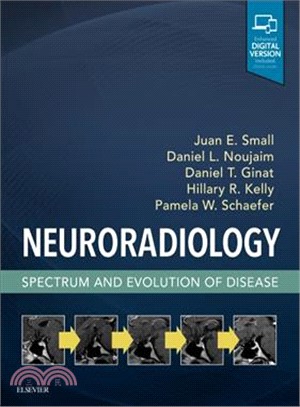 Neuroradiology ― Spectrum and Evolution of Disease