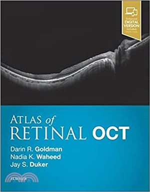 Atlas of Retinal Oct ─ Optical Coherence Tomography