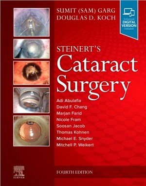 Steinert's Cataract Surgery
