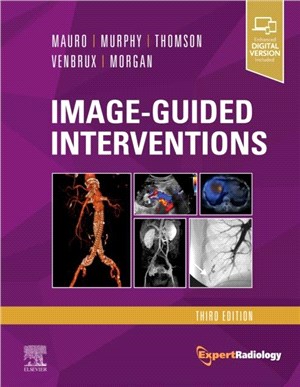 Image-Guided Interventions：Expert Radiology Series