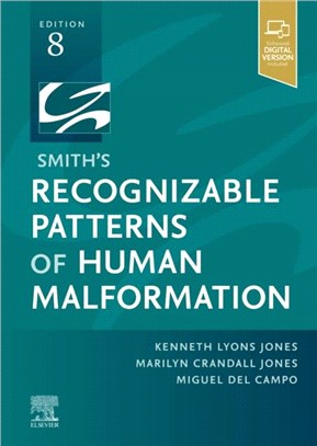 Smith'S Recognizable Patterns of Human Malformation