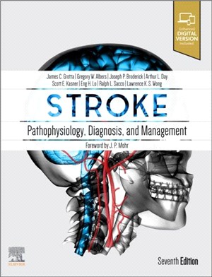 Stroke：Pathophysiology, Diagnosis, and Management