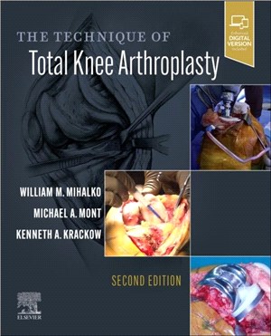 The Technique of Total Knee Arthroplasty