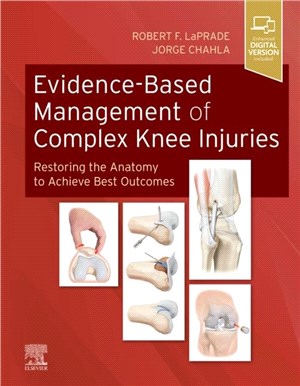 Evidence-Based Management of Complex Knee Injuries：Restoring the Anatomy to Achieve Best Outcomes