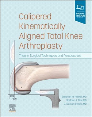 Calipered Kinematically aligned Total Knee Arthroplasty：Theory, Surgical Techniques and Perspectives