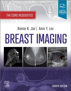Breast Imaging：The Core Requisites