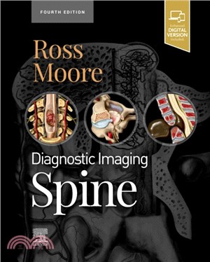 Diagnostic Imaging: Spine