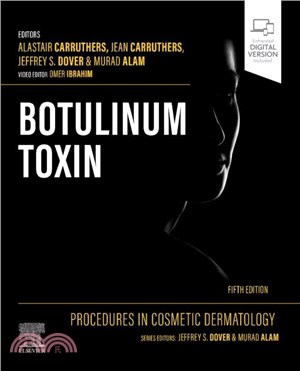 Procedures in Cosmetic Dermatology: Botulinum Toxin