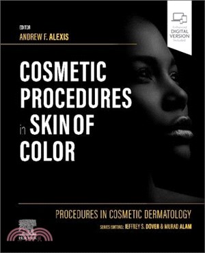 Procedures in Cosmetic Dermatology: Cosmetic Procedures in Skin of Color