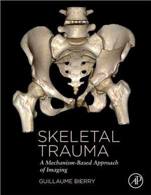 Skeletal Trauma：A Mechanism-Based Approach of Imaging