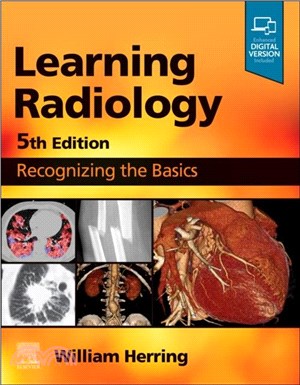 Learning Radiology：Recognizing the Basics