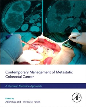 Contemporary Management of Metastatic Colorectal Cancer：A Precision Medicine Approach