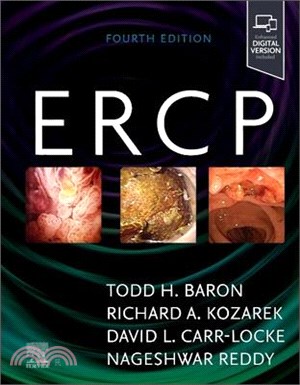 Ercp