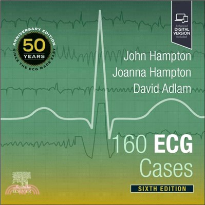 160 ECG Cases