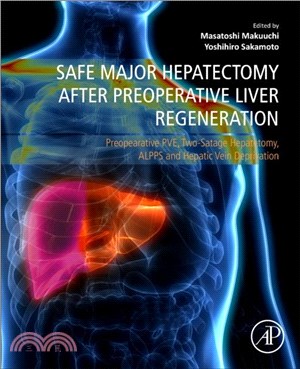 Safe Major Hepatectomy after Preoperative Liver Regeneration：Preopearative PVE, Two-Satage Hepatetomy, ALPPS and Hepatic Vein Deprivation