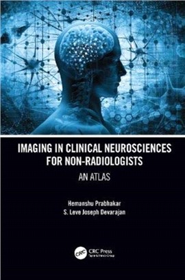 Imaging in Clinical Neurosciences for Non-radiologists：An Atlas