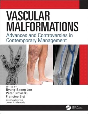 Vascular Malformations ― Advances and Controversies in Contemporary Management