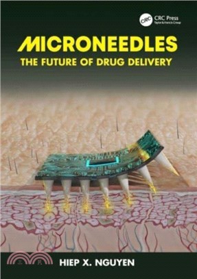 Microneedles：The Future of Drug Delivery