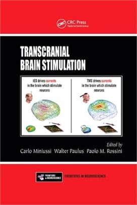 Transcranial Brain Stimulation