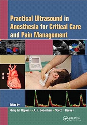 Practical Ultrasound in Anesthesia for Critical Care and Pain Management