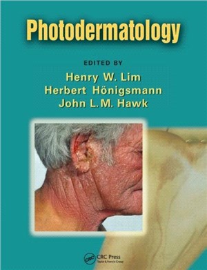 Photodermatology