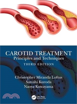 Carotid Treatment: Principles and Techniques