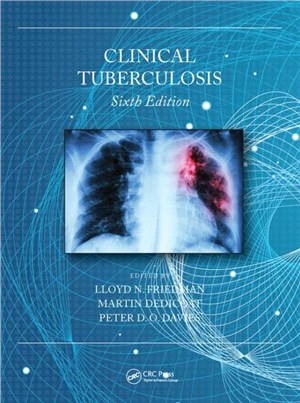 Clinical Tuberculosis