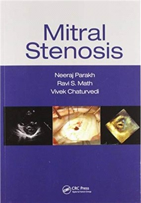 Mitral Stenosis