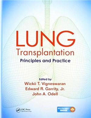 Lung Transplantation：Principles and Practice