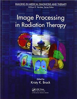 Image Processing in Radiation Therapy